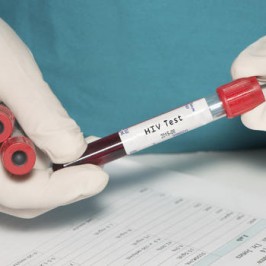 Mitos Seputar HIV AIDS